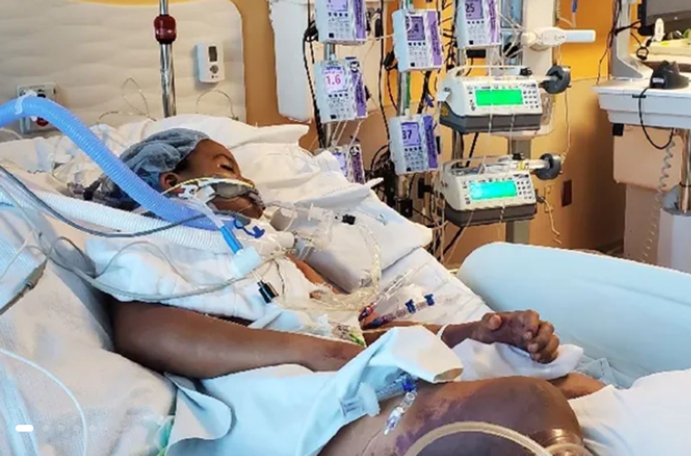 Niño pierde piernas por gripe; madre advierte
