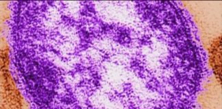 Georgia health officials report first measles case of 2026 in baby too young for vaccine