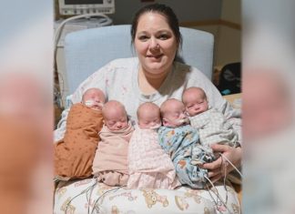 An update on the quintuplets born in Buffalo