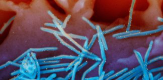 RSV season stretches into spring, prompting some regions to extend immunization window