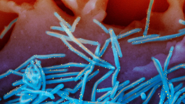 RSV season stretches into spring, prompting some regions to extend immunization window